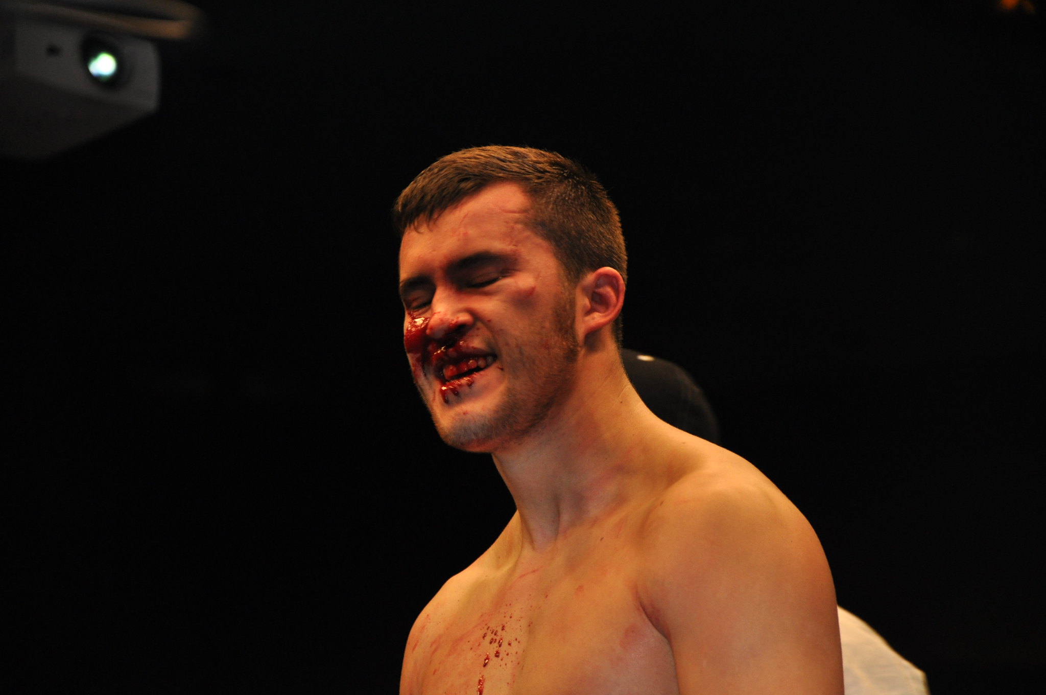 do mma fighters lose teeth